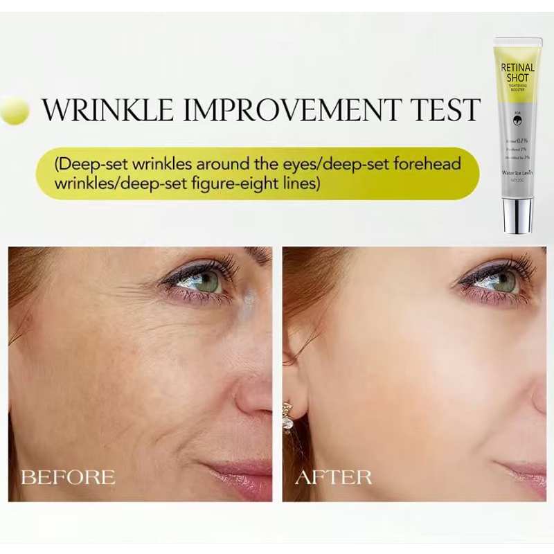 Retinal 0.1% Intensive Shot Pa - The Ordinary Serum Hyaluronic Acid review and price