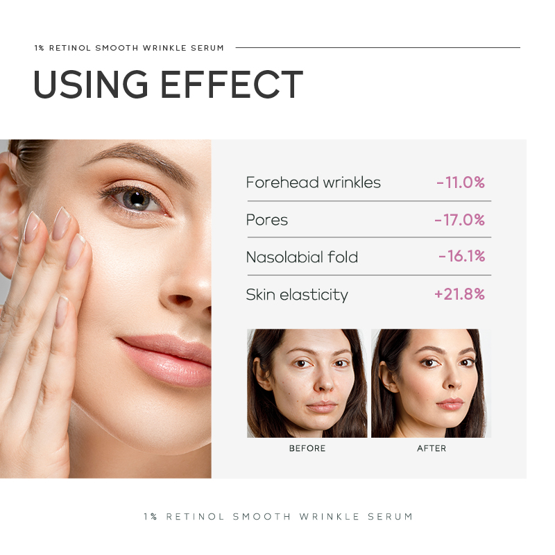 Quiyum 1% Retinol Smooth Wrink - The Ordinary Serum Hyaluronic Acid review and price